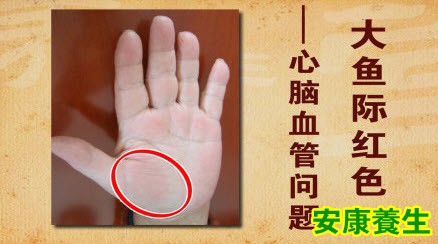 《养生堂》20140201视频和笔记:韩学杰讲手诊,反射区,大鱼际,颜色厚薄