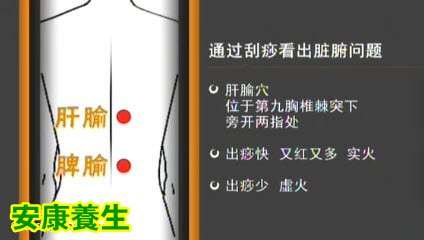 家政女皇20150324视频和笔记肝火旺的症状肝火如何分虚实实火的表现
