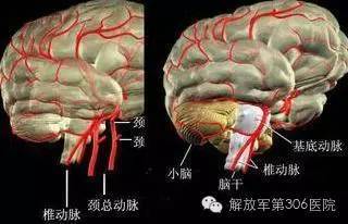 脑供血不足的症状有哪些？