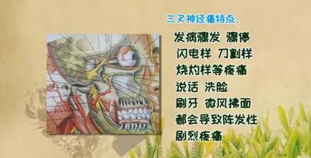 饮食养生汇20171024三叉神经痛的性质,特点和预防
