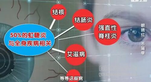 认识虹睫炎