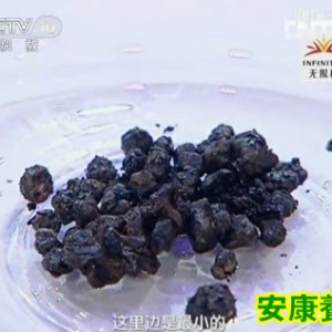 20130827《健康之路》视频和笔记:张洪义讲胆结石,胆囊,夜猫子,胆汁