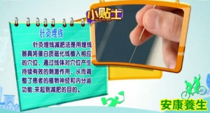 健康有道20130819视频:傅杰英讲减肥燕麦针灸埋线神门穴