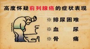 《养生堂》视频和笔记:夏术阶讲前列腺癌的症状表现，前列腺癌骨转移 降低前列腺癌发病率