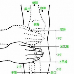 《养生堂》20130510李乾构：胃病的症状 胃炎,胃食管反流,芡实,肝郁