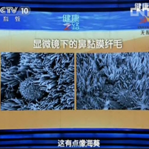 《健康之路》视频:周兵讲鼻涕 脑脊液漏 鼻窦 鼻痂