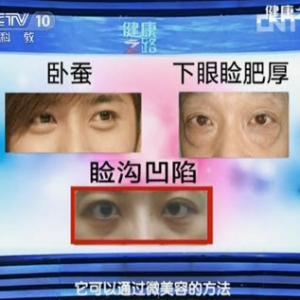 《健康之路》视频:范先群讲小整形大改变 肿眼泡 眼袋 卧蚕 下眼睑肥