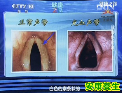 声带