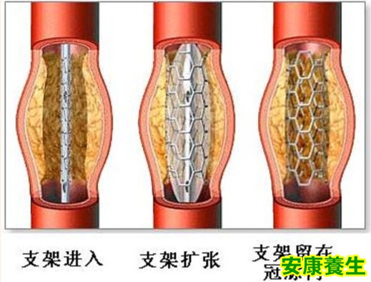 心脏
