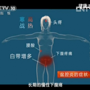 《健康之路》视频魏丽慧:女性肚子疼的原因 子宫内膜异位症 盆腔炎 宫外孕相关内容