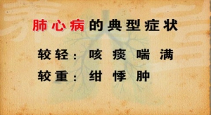 《养生堂》视频:周平安 姜苗讲肺心病的典型症状 病毒性心肌炎的典型症状