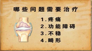 《养生堂》20130331视频:吕厚山讲人工关节材料的选择，人工关节置换的黄金年龄