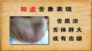 《养生堂》20130315视频:李忠讲阳气虚有哪些症状、阳气虚的舌象、恶性肿瘤在耳朵上的表现