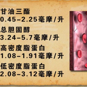 《养生堂》20130211视频:武剑讲脑梗死、高血压和脑血管疾病、脑血管斑块的形成和危害
