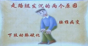 《健康之路》20131014视频:鞠上讲下肢动脉堵塞、走路腿发沉如何锻炼、腰椎病变引起的腿沉
