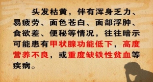 《养生堂》20131015视频:张广中讲头发颜色异常的危险、胎毛增多症、祛脂外洗方