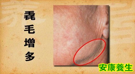 毳毛