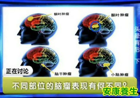 脑瘤