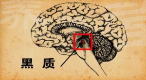 《养生堂》20131020视频:李勇杰讲如何预防或延缓帕金森病的发生、帕金森病的风险因素、特  ...