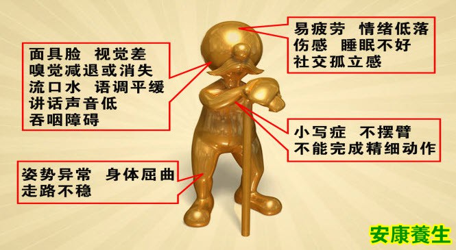 帕金森