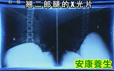 二郎腿
