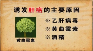《养生堂》20131116视频:栗光明讲影响肝脏健康的生活习惯、保肝护胆、黄曲霉素、肝脏健康