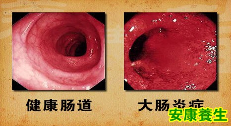 免疫系统