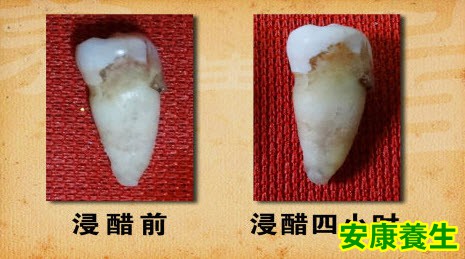 牙齿