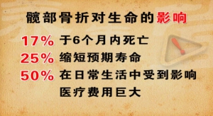 《养生堂》20131126视频:付中国讲髋部骨折对生命的影响、防老年人摔倒、平衡功能自测