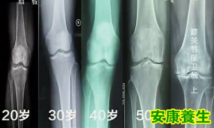 膝关节