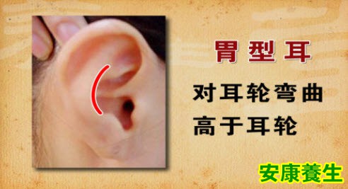 补中益气汤