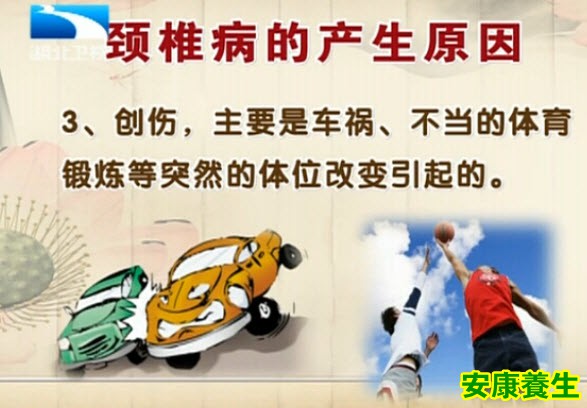 颈椎病