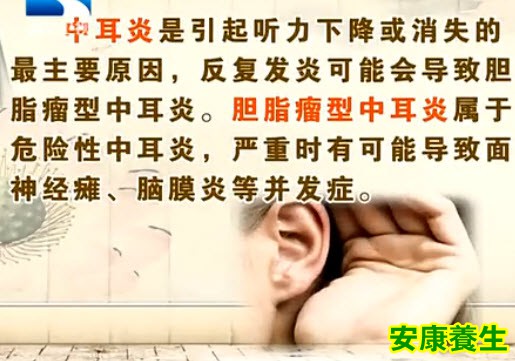 中耳炎