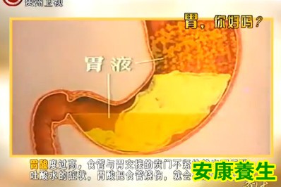 胃酸