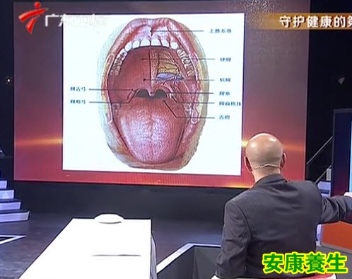 口腔癌