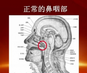健康有道20131210视频:黎静讲诱发鼻咽癌的因素,早期症状,鼻咽癌的治疗,鼻咽癌专项检查