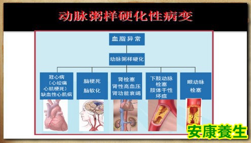 动脉粥样硬化性病变