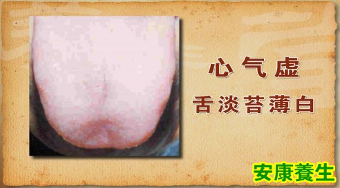心气虚