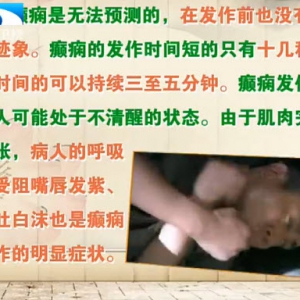 饮食养生汇20131216视频和笔记:李锐讲癫痫,癫痫发作,麻花炒牛蛙