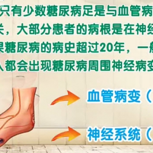 饮食养生汇20131217视频和笔记:张黎讲糖尿病周围神经痛,跳水鱼