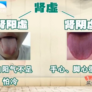 饮食养生汇20131230视频和笔记:肖相如讲肾阴虚,肾阳虚,龟龄集