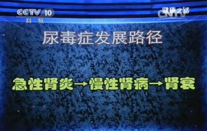 《健康之路》20140117视频和笔记:刘文虎讲尿毒症,肾衰,肾病,透析
