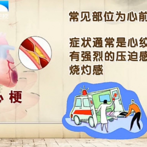 饮食养生汇20140124视频和笔记:励建安讲心梗,心绞痛,冠心病