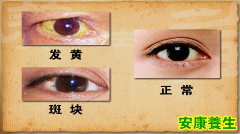 胰腺和眼睛的关系