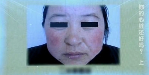 《健康之路》20140217视频和笔记:周玉杰讲猝死,体型和心脏病,冠心病的危险因素,性格与心脏 ...