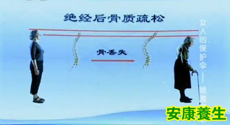 骨质疏松