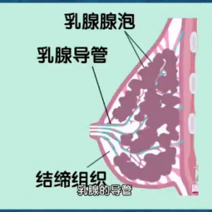 我是大医生20140318视频笔记:乳房健康,乳腺增生自检,乳腺癌,预防乳腺癌的饮食