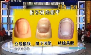 贵州卫视20140319养生：罗增刚讲手诊,肠道不好的表现,肾不好的体征,肝不好的体征