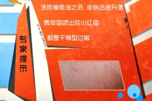 家政女皇20140408视频笔记:翟艳欣讲皮肤过敏,补水,抗敏,手撕菜