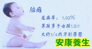 脑瘫